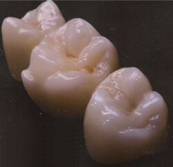 白い歯のメリット