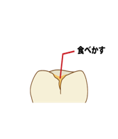 私たちの口の中で一日中何が起こるのですか？