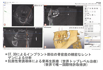 レントゲン写真